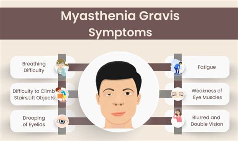 Myasthenia Gravis Symptoms and Treatment, Dr. Tarun Mathur