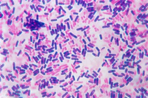 Gramkleuringsprocedure in onderzoek en laboratoria - Med NL