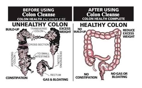 10 Best Food & Diet Meal Plan for Colon Cleanse Weight Loss