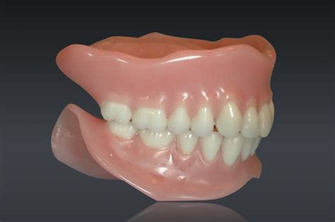 Conventional Complete Denture Fabrication in 9 Steps - Spear Education