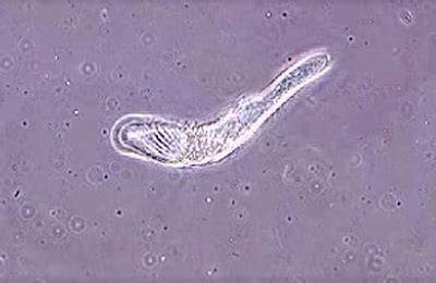 Spirostomum (Protozoan) Videos | Nikon’s MicroscopyU