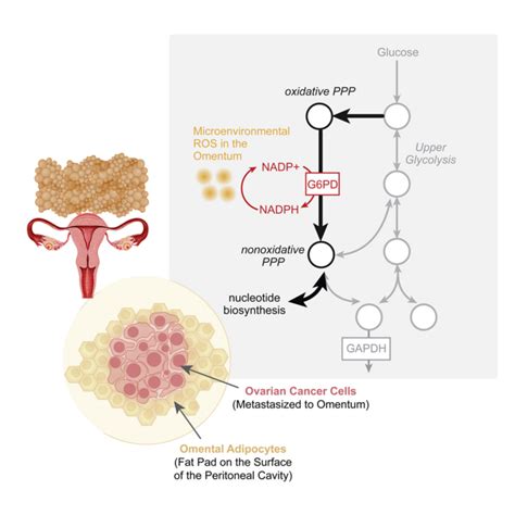 Ovarian cancer in the fatty omentum: Metaboli | EurekAlert!