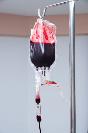 Study Recommends Practices That Reduce Risk of Iatrogenic Anemia