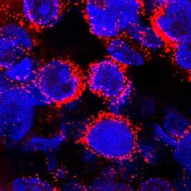 alpha 2-Macroglobulin Antibody [Unconjugated] (AF1938): Novus Biologicals