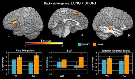 Broca’s area doesn’t care what you do (syntactically): it cares how you do it (actively) Speech ...