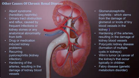 Chronic Kidney Disease: Stages of Progression and Impact on Pregnancy - Scientific Animations