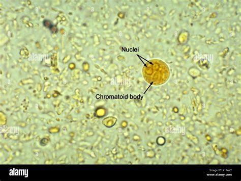 This iodine-stained photomicrograph revealed ultrastructural morphology exhibited by a ...