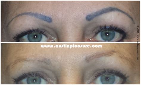 eyebrow tattoo removal cream - Full Grown Journal Pictures Library