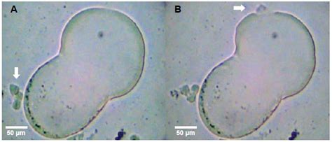 Trichomonas Hominis