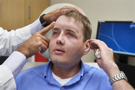 Face Transplant Surgery: Permissible?