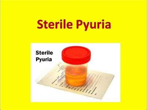 Sterile Pyuria || Sterile Pyuria Causes - YouTube