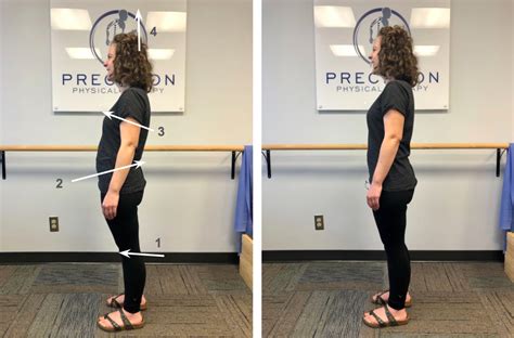 Can you fix slouched posture? — Precision Physical Therapy