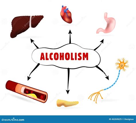 Physical Effects Of Alcoholism Stock Vector - Image: 46269625