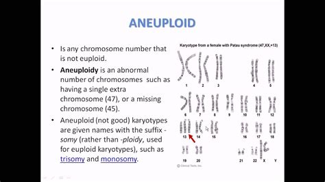 What is aneuploidy - YouTube