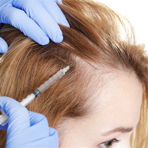 Treatment for Alopecia at Philadelphia Homeopathic Clinic by Dr. Tsan