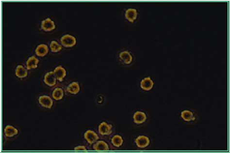 Hybridoma cells grown in tissue culture. Credit: Gerry Shaw, the EnCor... | Download Scientific ...