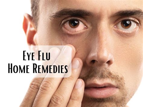 Eye Flu Home Remedies: How To Deal With Conjunctivitis or Pink Eye ...