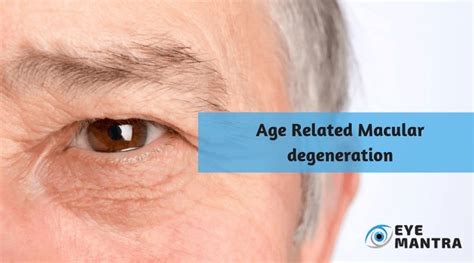 Macular Degeneration (AMD)- Causes and Treatment