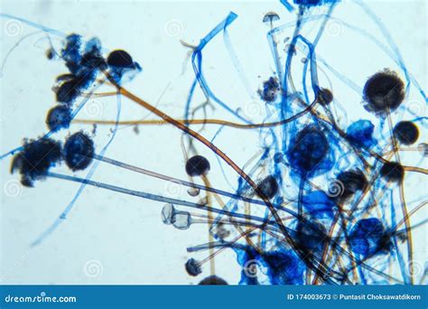 Rhizopus Under Compound Microscope