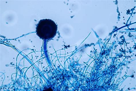 What Does Mold Look Like Under a Microscope? Facts, Types & Tips - Optics Mag