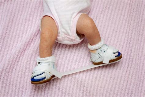 Newborn Orthopedic Shoes stock image. Image of footwear - 111898139