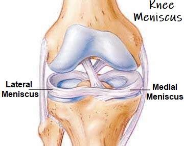 Knee Meniscus: Function & Injuries - Knee Pain Explained