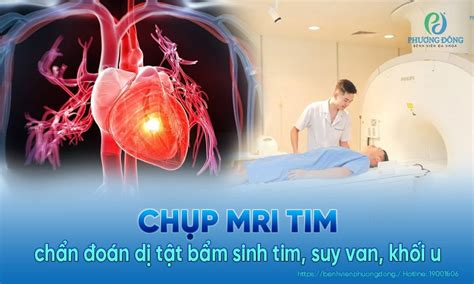 Chụp MRI tim là gì? Kỹ thuật cộng hưởng từ tim có rủi ro nào không?