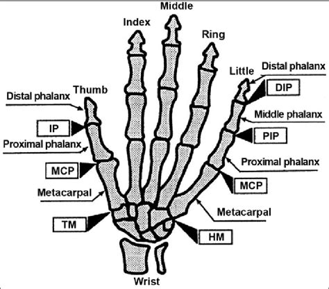 Human hand skeleton model. DIP = distal interphalangeal, HM = hamate ...