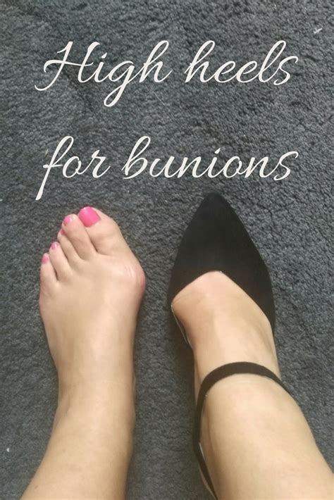 Pin on Beautiful shoes for bunions