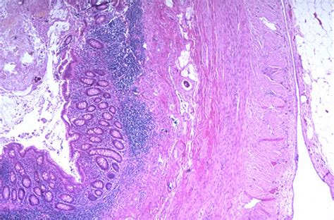 Normal Histology