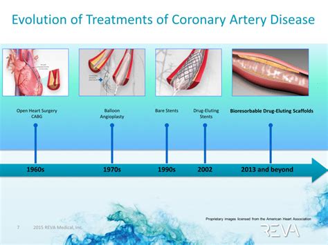 What Is Coronary Artery Disease Treatment - PELAJARAN