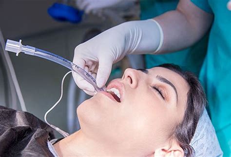 Intubation Explained: Why And When Intubation Is, 57% OFF