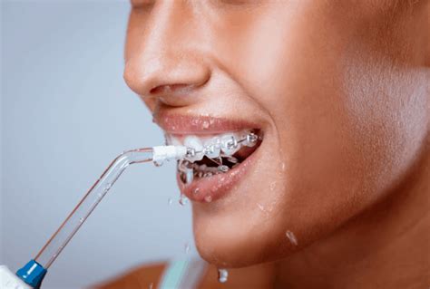 Best Water Flosser for Braces - How to Choose the Right One - Dentalisty