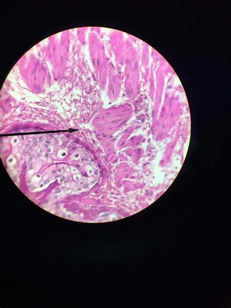 Transitional Epithelium Microscope