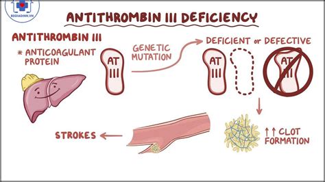 ANTITHROMBIN III (AT III) là gì? Vì sao cần làm xét nghiệm ANTITHROMBIN ...