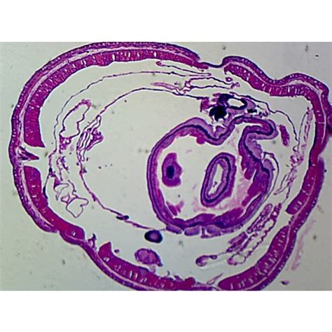 Prepared Microscope Slide,Zoology; Earthworms Setae C.S. M-Stain.