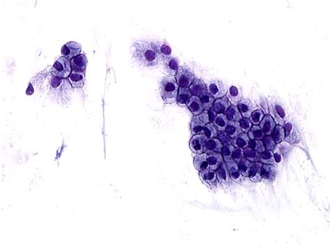 Cytopathology of the uterine cervix - digital atlas