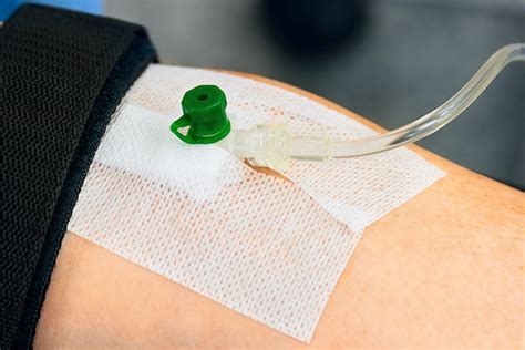 Tips and Techniques for Inserting an IV Cannula