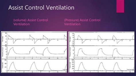 Basic modes of mechanical ventilation