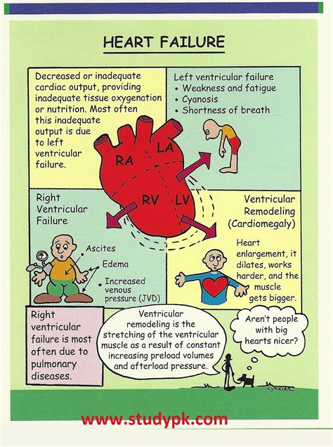 Heart Failure Concept Map Nursing