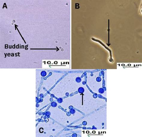 Candida Albicans Microscope Slide