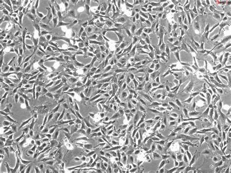 Human Renal Mesangial Cells (HRMC)