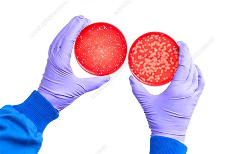 E. coli bacterial cultures - Stock Image - C036/1208 - Science Photo Library