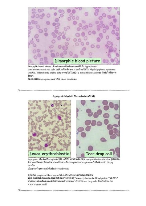 Peripheral Blood Smear Staining Procedure