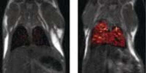 Imaging of Scar Tissue Formation | Lab Manager