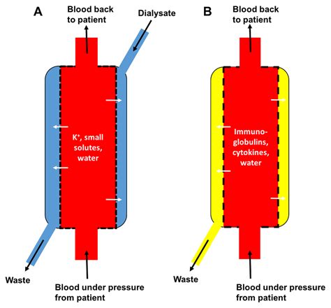 Dialysis and Therapeutic Plasma Exchange