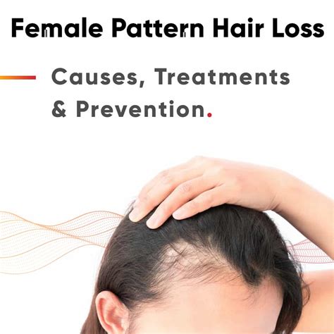 Female Pattern Baldness: An In-Depth Look at Androgenetic Alopecia in ...