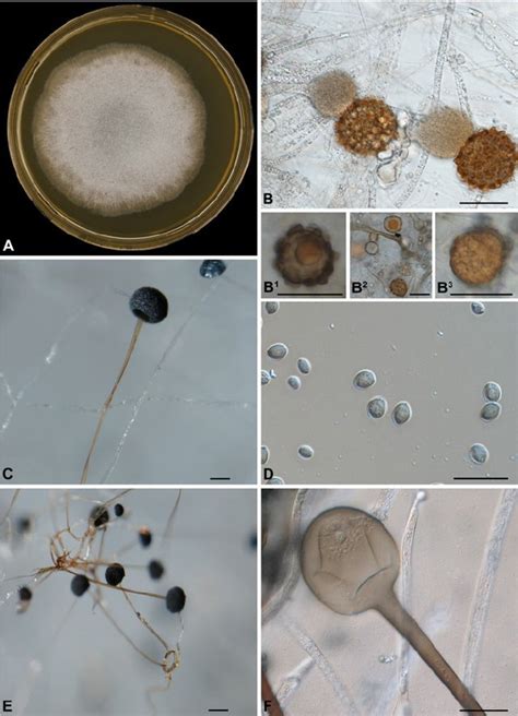 Rhizopus spp- An Overview