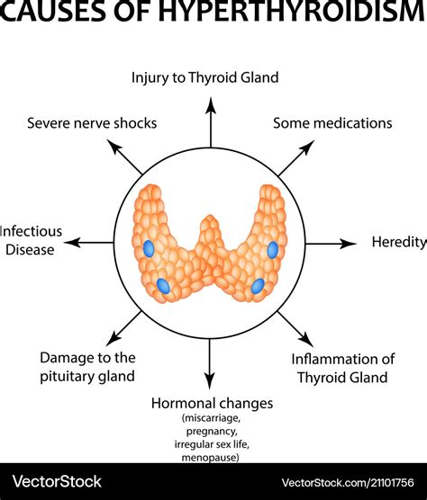 The causes of hyperthyroidism of the thyroid gland