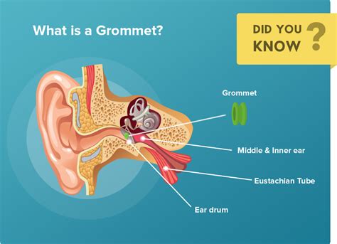 Kids, Grommets, and Private Health Cover | Health Insurance Comparison | Health insurance ...